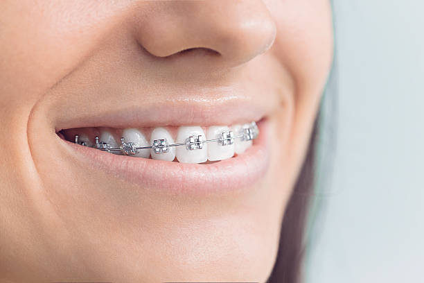Best Veneers and Lumineers  in Sea Ranch, CA